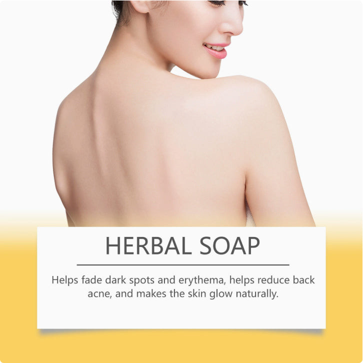 Turmeric Herbal Skincare Soap – view 4